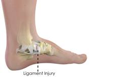 Ligament