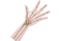 Forearm Fractures