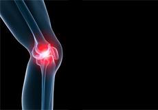 Generalized Knee Pain