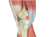 MCL Anatomy